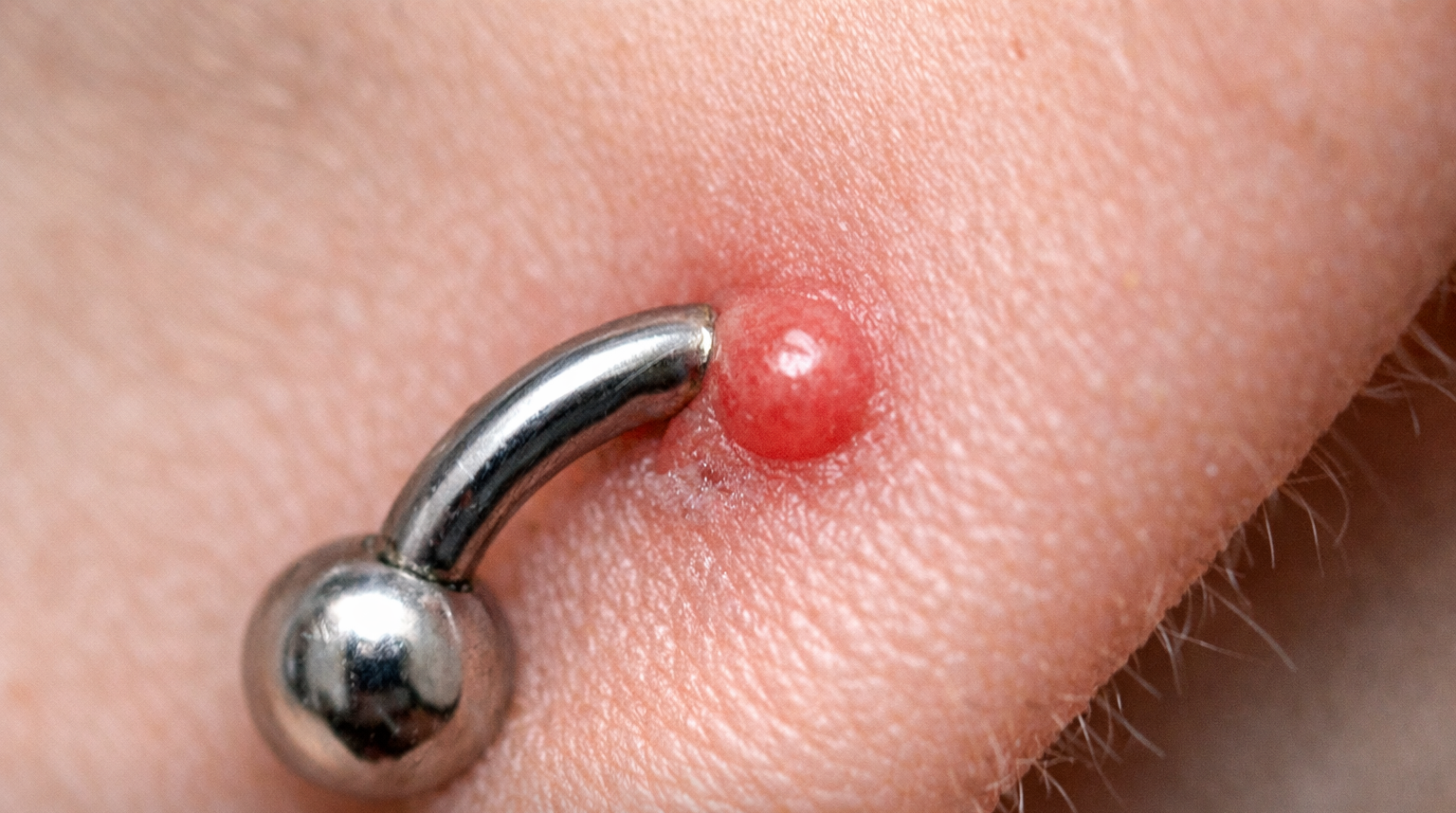 Bollicina accanto al piercing durante la fase di guarigione